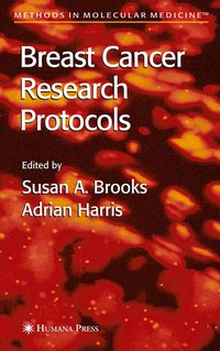 Produktbild: Breast Cancer Research Protocols