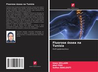 Produktbild: Fluorose &oacute;ssea na Tun&iacute;sia