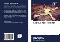 Produktbild: Kostnyj transplantat