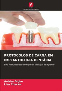Produktbild: Protocolos De Carga Em Implantologia Dent&aacute;ria