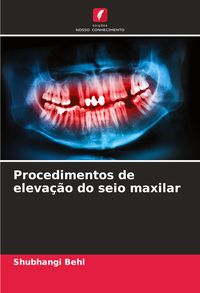 Produktbild: Procedimentos de eleva&ccedil;&atilde;o do seio maxilar