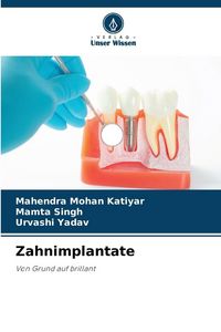 Produktbild: Zahnimplantate