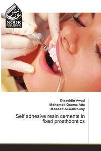 Produktbild: Self adhesive resin cements in fixed prosthdontics
