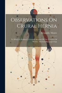Produktbild: Observations On Crural Hernia