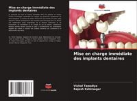 Produktbild: Mise en charge imm&eacute;diate des implants dentaires
