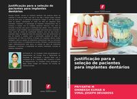 Produktbild: Justifica&ccedil;&atilde;o para a sele&ccedil;&atilde;o de pacientes para implantes dent&aacute;rios