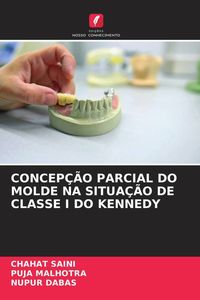 Produktbild: Concep&ccedil;&atilde;o Parcial Do Molde Na Situa&ccedil;&atilde;o De Classe I Do Kennedy