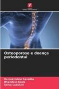 Produktbild: Osteoporose e doen&ccedil;a periodontal