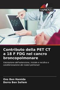 Produktbild: Contributo della PET CT a 18 F FDG nel cancro broncopolmonare