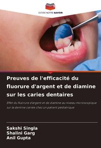 Produktbild: Preuves de l'efficacit&eacute; du fluorure d'argent et de diamine sur les caries dentaires