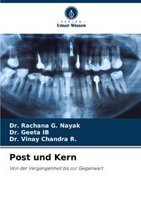 Produktbild: Post und Kern