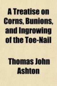 Produktbild: A Treatise on Corns, Bunions, and Ingrowing of the Toe-Nail