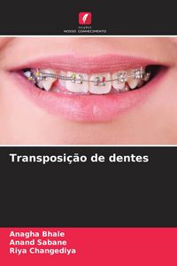 Produktbild: Transposi&ccedil;&atilde;o de dentes