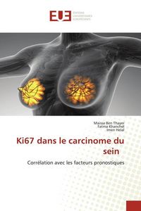 Produktbild: Ki67 dans le carcinome du sein