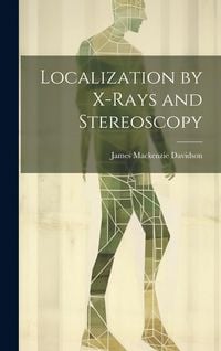 Produktbild: Localization by X-Rays and Stereoscopy
