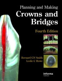 Produktbild: Smith, B: Planning and Making Crowns and Bridges
