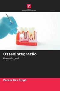 Produktbild: Osseointegra&ccedil;&atilde;o