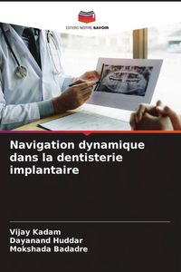 Produktbild: Navigation dynamique dans la dentisterie implantaire