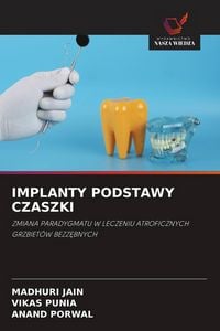 Produktbild: IMPLANTY PODSTAWY CZASZKI