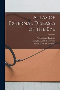 Produktbild: Atlas of External Diseases of the Eye [electronic Resource]