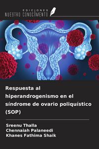 Produktbild: Respuesta al hiperandrogenismo en el s&iacute;ndrome de ovario poliqu&iacute;stico (SOP)