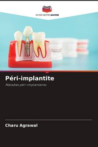 Produktbild: P&eacute;ri-implantite