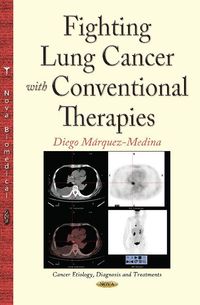 Produktbild: Fighting Lung Cancer with Conventional Therapies