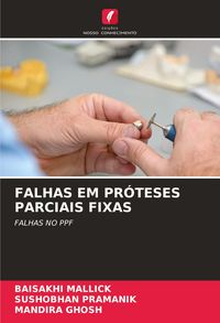 Produktbild: FALHAS EM PR&Oacute;TESES PARCIAIS FIXAS