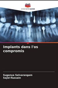 Produktbild: Implants dans l'os compromis