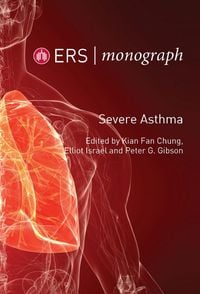 Produktbild: Severe Asthma