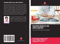Produktbild: Biomec&acirc;nica De Implantes
