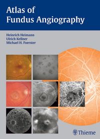 Produktbild: Atlas of Fundus Angiography