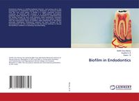 Produktbild: Biofilm in Endodontics