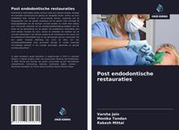 Produktbild: Post endodontische restauraties
