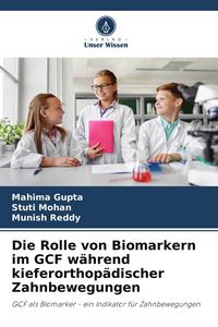 Produktbild: Die Rolle von Biomarkern im GCF w&auml;hrend kieferorthop&auml;discher Zahnbewegungen