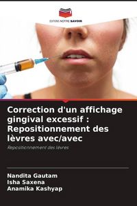 Produktbild: Correction d'un affichage gingival excessif : Repositionnement des l&egrave;vres avec/avec