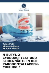 Produktbild: N-Butyl-2-Cyanoacrylat und Seidenn&auml;hte in der Parodontallappen-Chirurgie