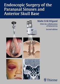 Produktbild: Endoscopic Surgery of the Paranasal Sinuses and Anterior Skull Base