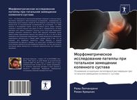 Produktbild: Morfometricheskoe issledowanie patelly pri total'nom zameschenii kolennogo sustawa