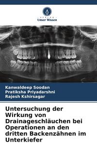 Produktbild: Untersuchung der Wirkung von Drainageschl&auml;uchen bei Operationen an den dritten Backenz&auml;hnen im Unterkiefer