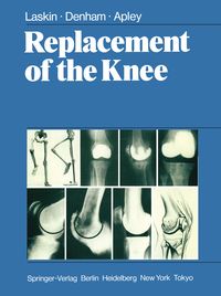 Produktbild: Replacement of the Knee