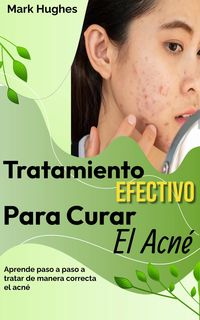 Produktbild: Tratamiento Efectivo Para Curar El Acn&eacute;: Aprende paso a paso a tratar de manera correcta el acn&eacute;