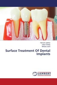 Produktbild: Surface Treatment Of Dental Implants