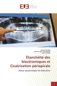 Produktbild: &Eacute;tanch&eacute;it&eacute; des bioc&eacute;ramiques et Cicatrisation p&eacute;riapicale