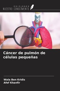 Produktbild: C&aacute;ncer de pulm&oacute;n de c&eacute;lulas peque&ntilde;as