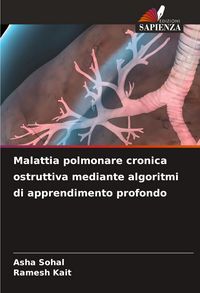 Produktbild: Malattia polmonare cronica ostruttiva mediante algoritmi di apprendimento profondo