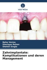Produktbild: Zahnimplantate: Komplikationen und deren Management