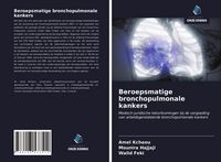 Produktbild: Beroepsmatige bronchopulmonale kankers