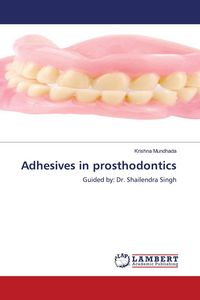 Produktbild: Adhesives in prosthodontics