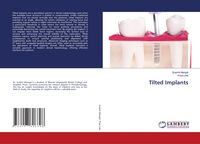 Produktbild: Tilted Implants